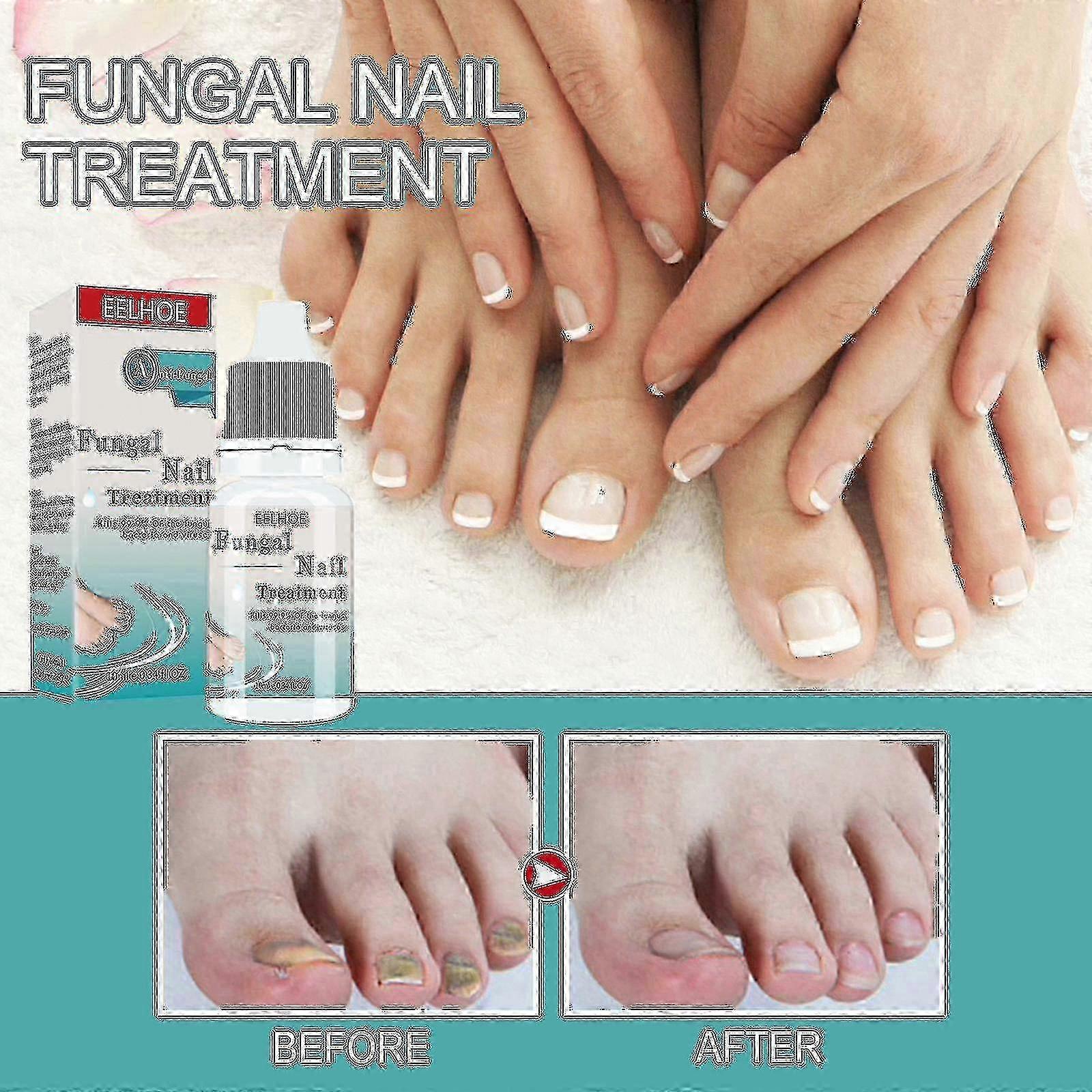 Nail Onycho Liquid Nail