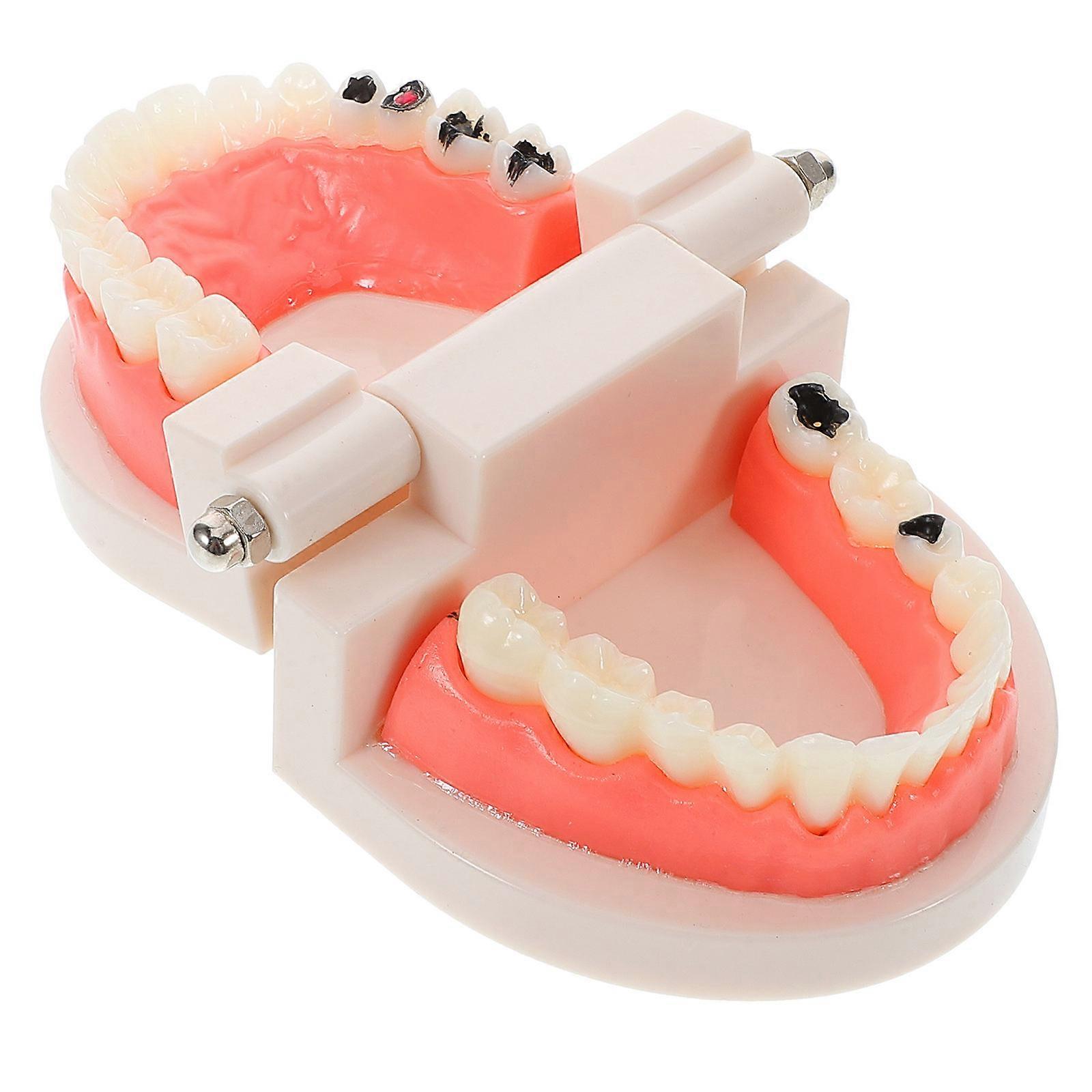 Dental Typodont Model for Professionals Realistic Teeth Structure Abs Material Oral Practice 1Pcs
