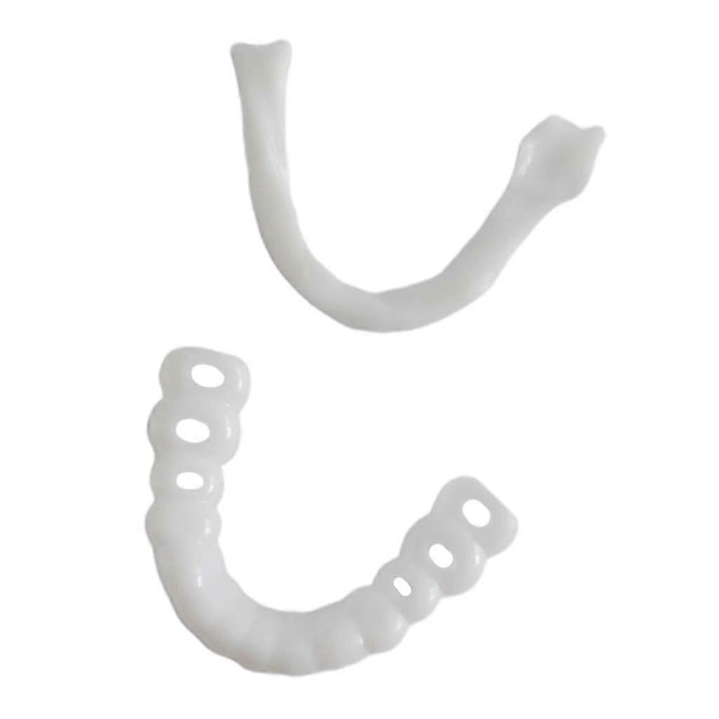Snap-On Cosmetic Teeth Cover Upper Only