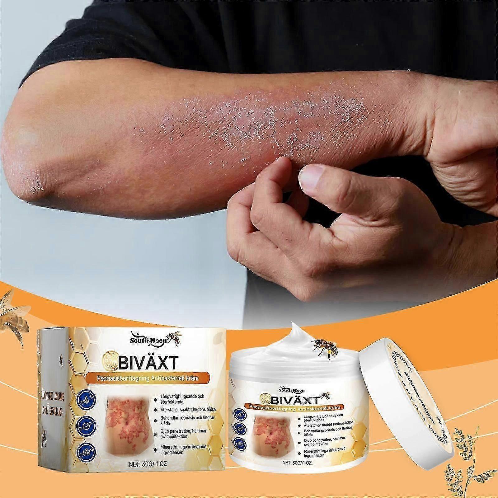 كريم سم النحل لعلاج الصدفية، كريم مضاد للحكة، كريم لتخفيف الحكة، منتجات العناية بالبشرة