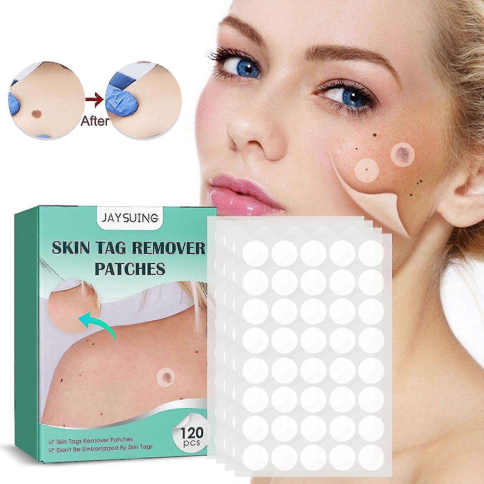 Skin Tag Remover Pflaster