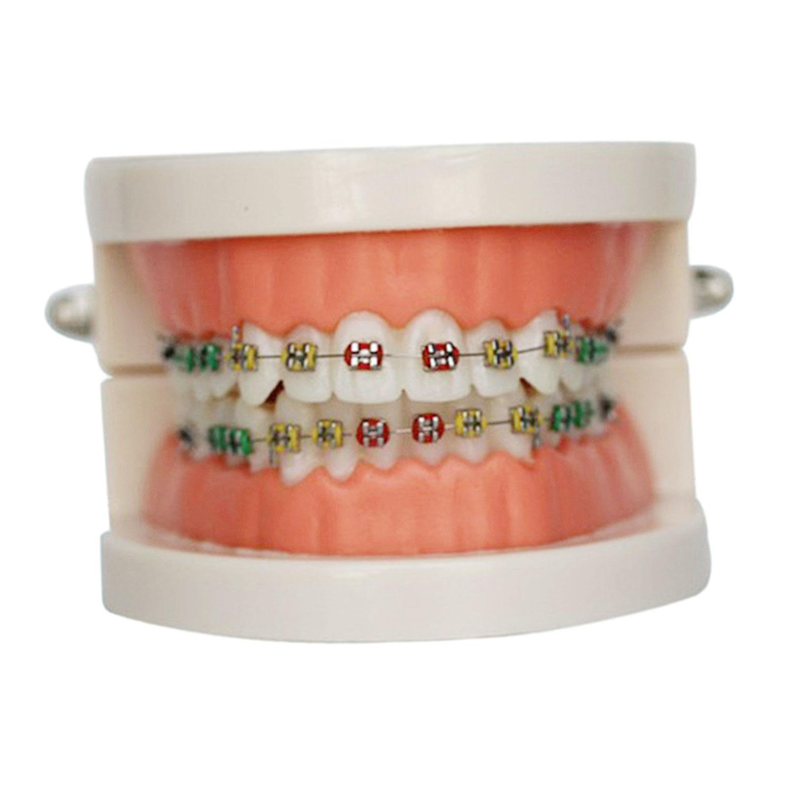 Teaching Model with Metal Brace Teaching Practice Practice Teacher Student Demonstration Tool Classroom Teaching Model