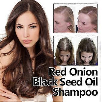 A1 3PC red onion black seed oil hair care essential oil nourishes hair care soft and mois