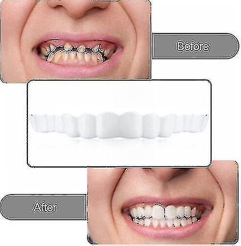 Smile Snap On False Teeth Upper Lower Dental Veneers Dentures Tooth Cover Set