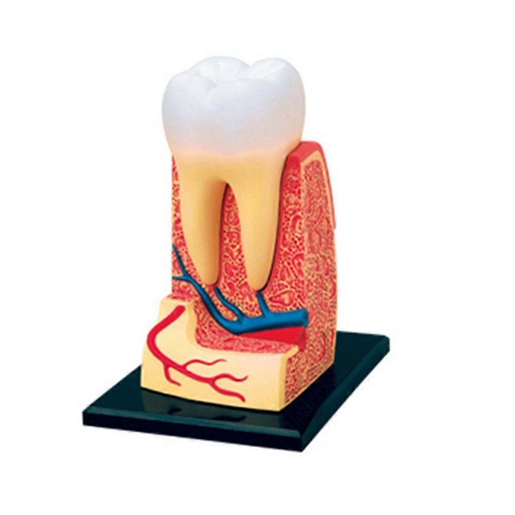 Dental Demonstration Model Crown Bridge Demonstration Teeth Model Removable Demonstration Study Teaching Teeth Model
