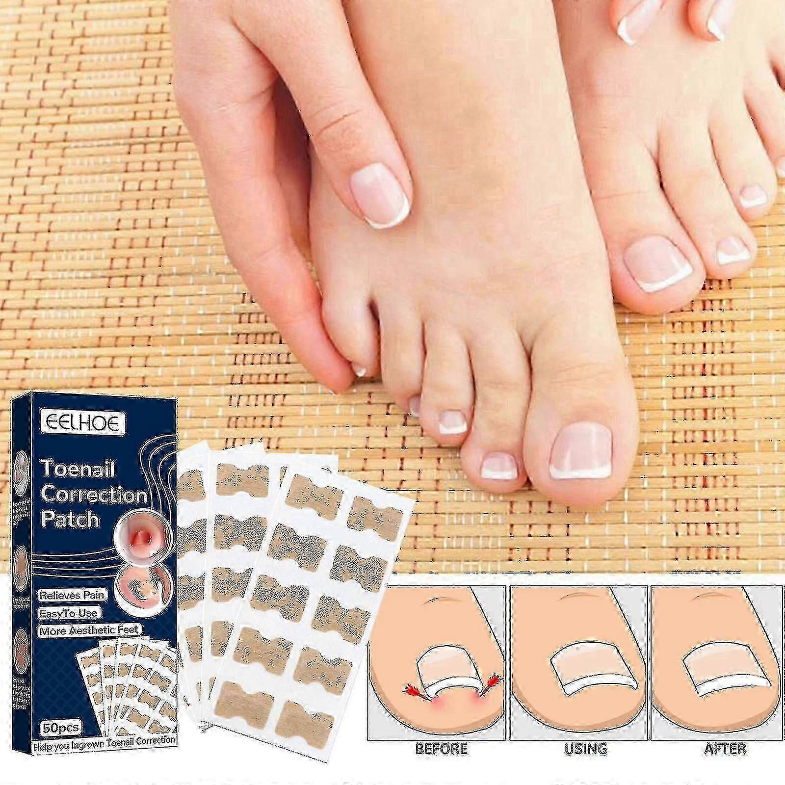 Eelhoe Toenail Correction Patch