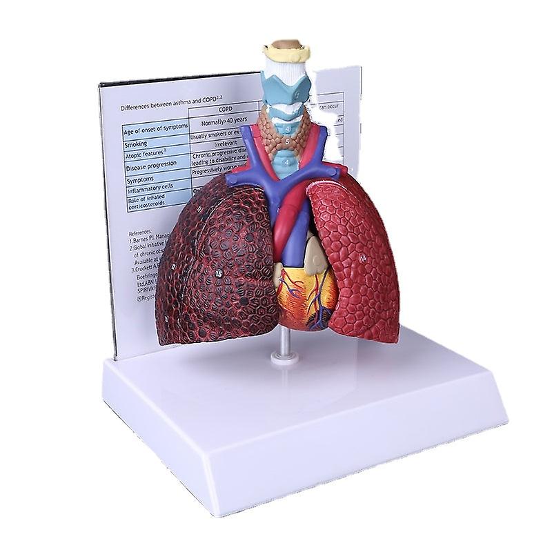 Life Size Human Lung Model Anatomical Respiratory System Anatomy For School Science Resources Study Display Teaching Tool