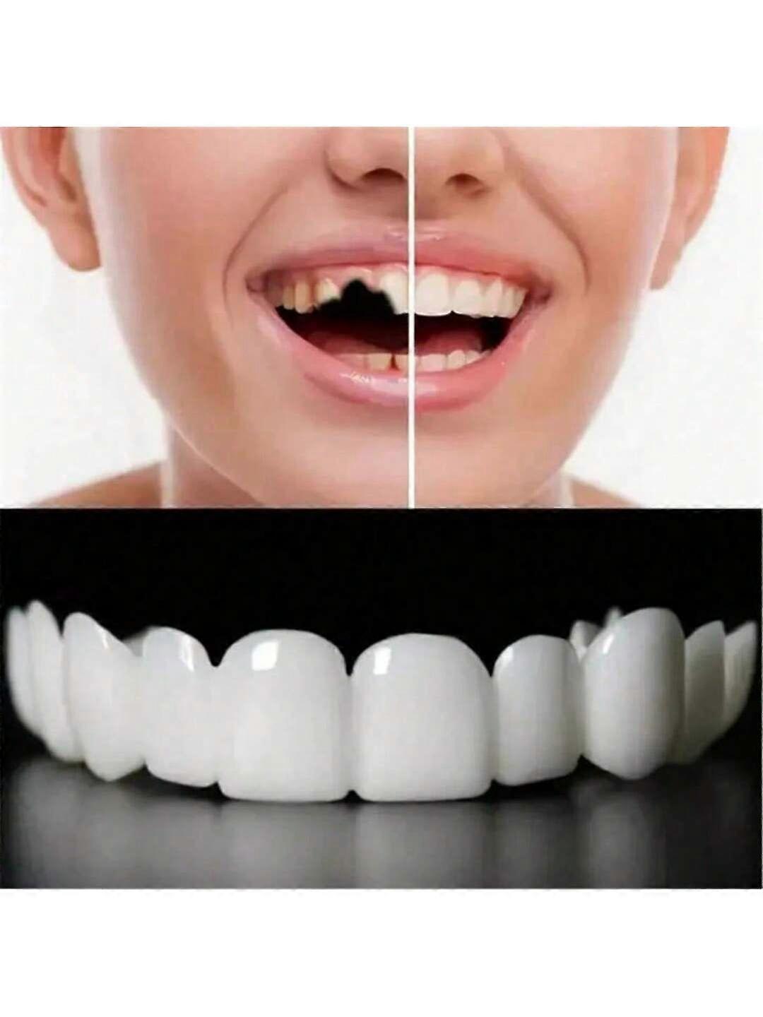 1 قطعة ابتسامة تبييض الأسنان طقم الديكور ، 2nd Gen ، سهل الاستخدام