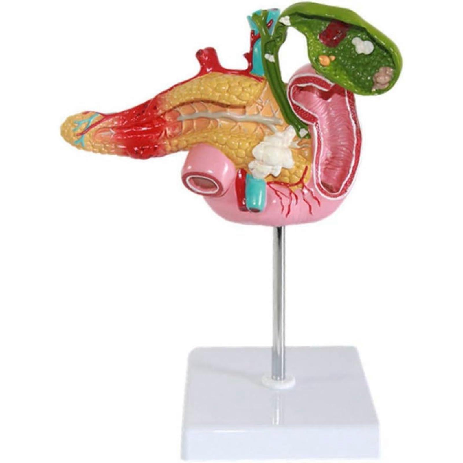 Pancreas and Duodenum Pathology Model for Medical Education Training
