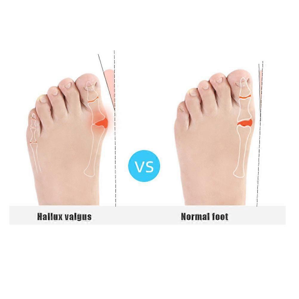 Orthopedic Bunion Splint L Size Black for Hallux Valgus Correction