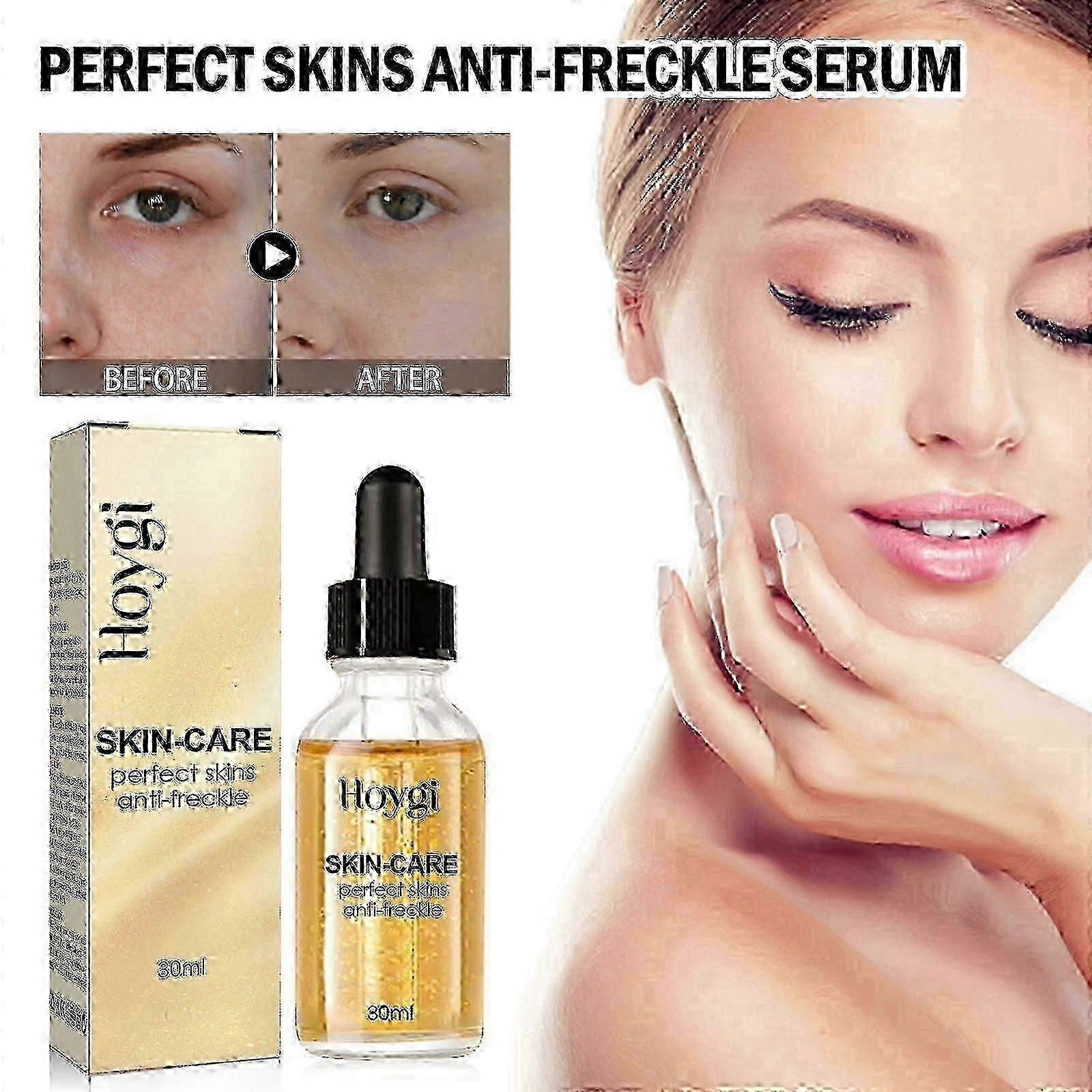 パーフェクトスキンズアンチそばかす美容液、ブライトニング、若返り、保湿、アンチリンクルエッセンス