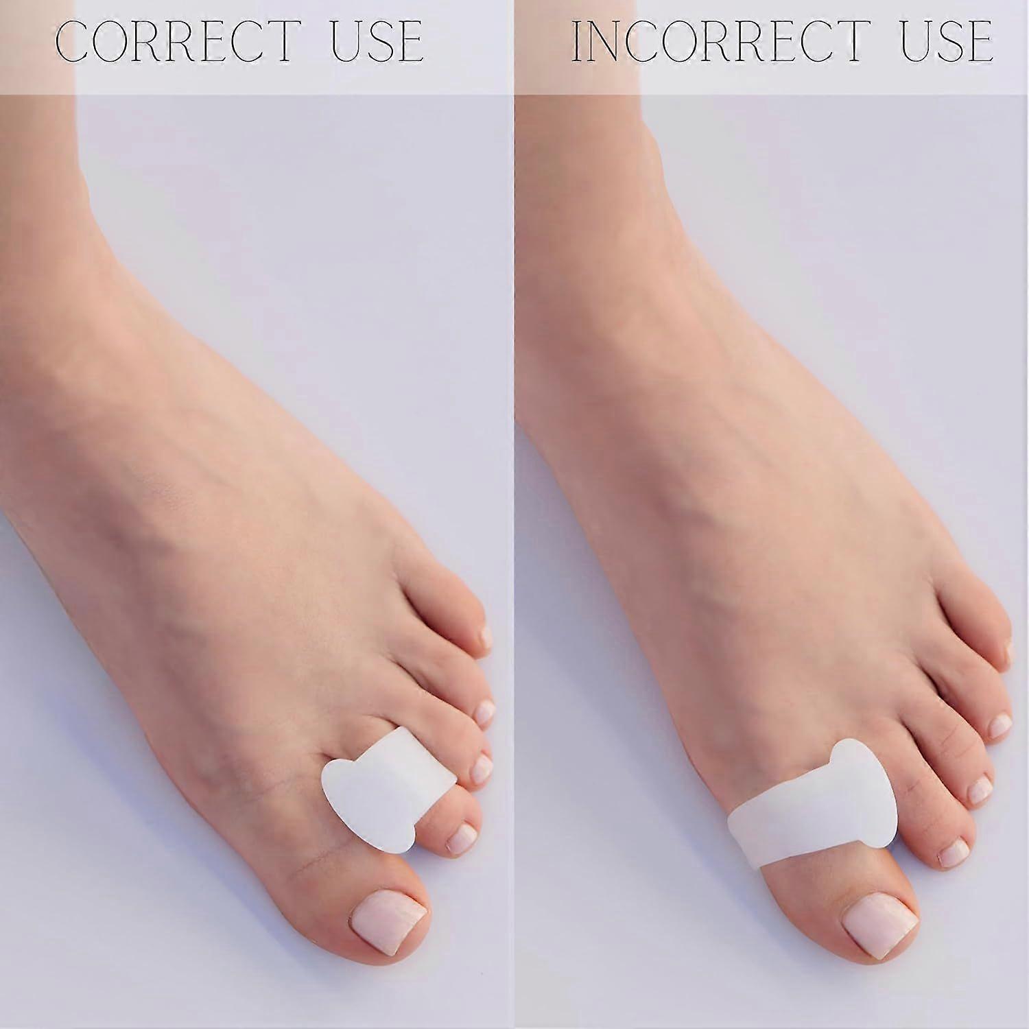Gel Toe Separators for Overlapping Toes, Bunions, Big Toe Alignment, Corrector