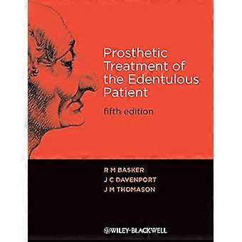 Prothetische Behandlung des Edentulous Patienten