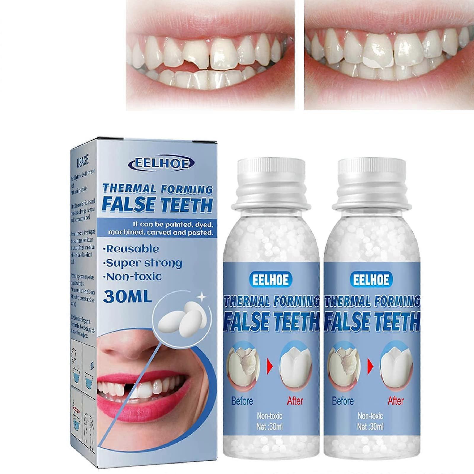 Temporary Tooth  Kit with Reusable Filling Beads for Missing or Broken Teeth