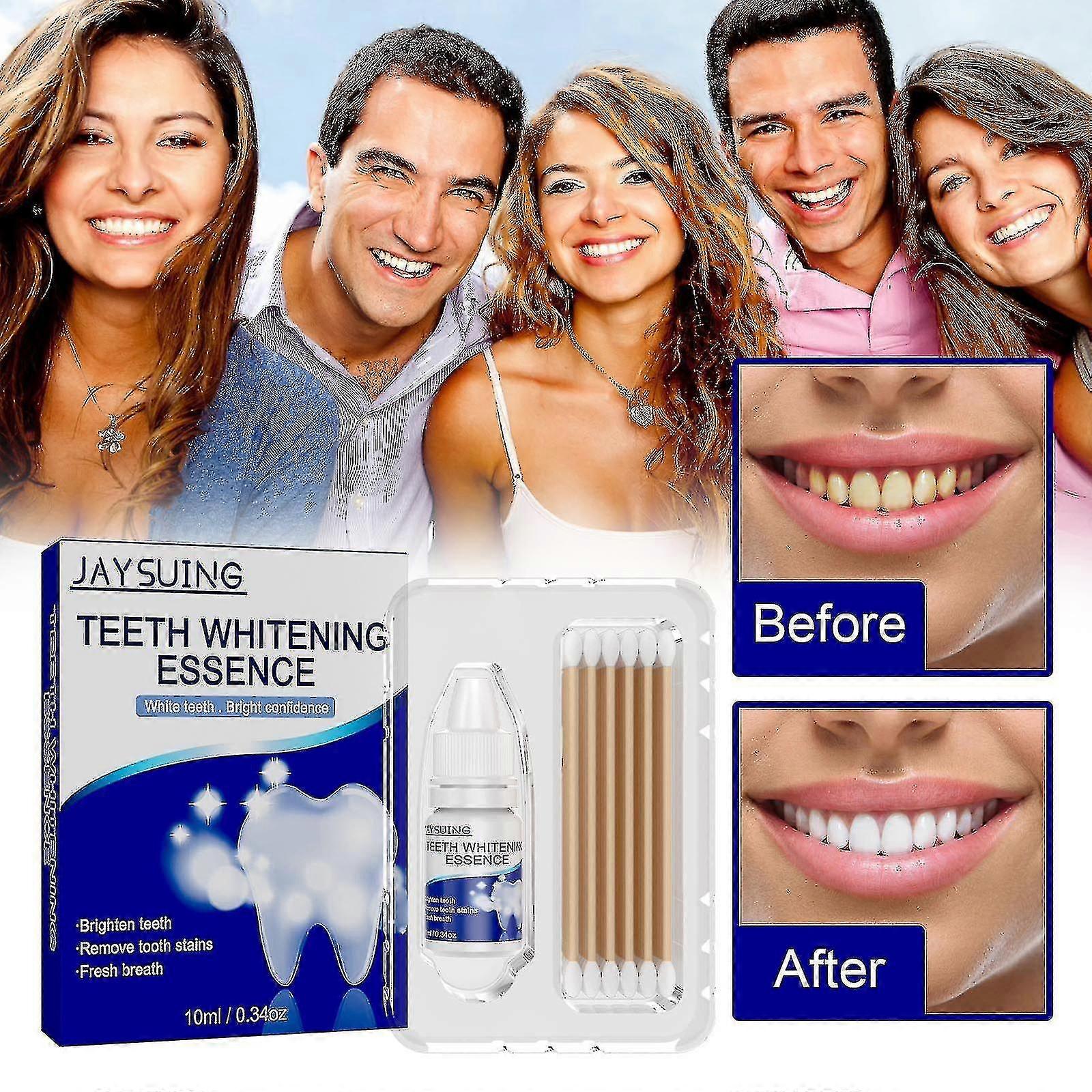 Plaque Cleansing Tooth Care Essence - Tartar Removal, Fresh Breath, Yellow Stains Elimination
