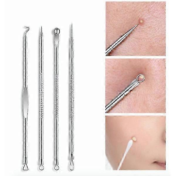 4-pack Blackhead Remover Tools for Easy Extraction