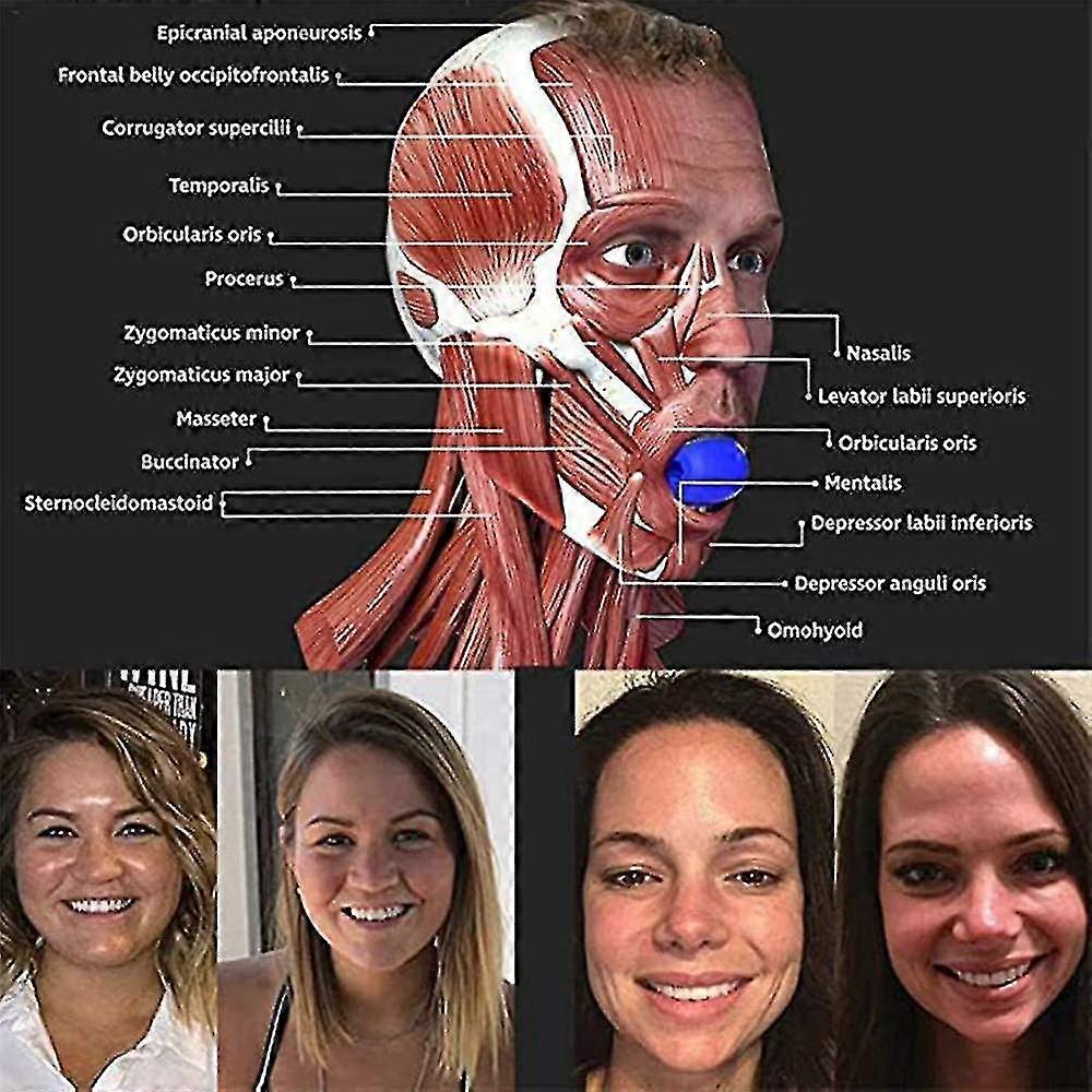 Facial Retractor, Neck/facial Jaw Trainer