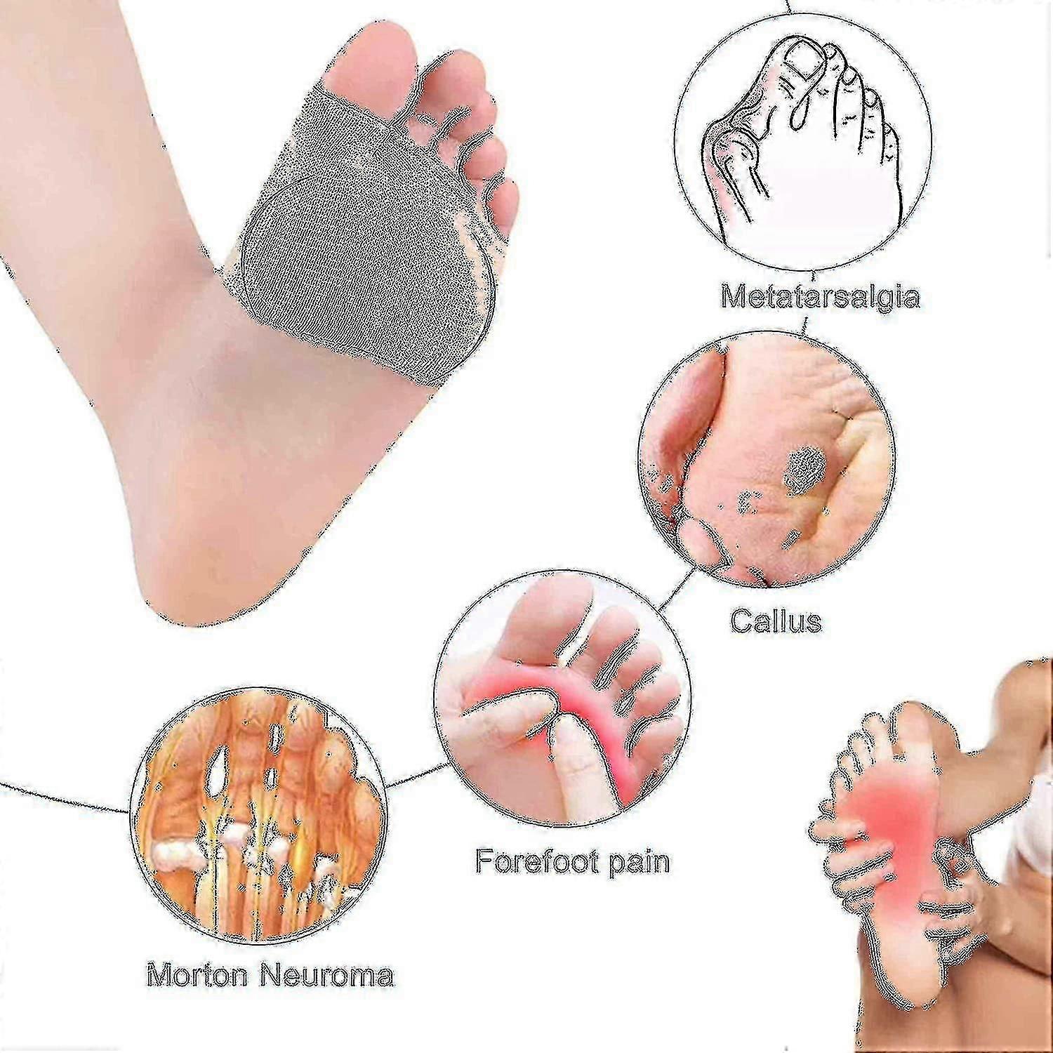 Metatarsalis párnák Metatarsalgia Morton Neuroma Sesamoiditis fájdalom Ref