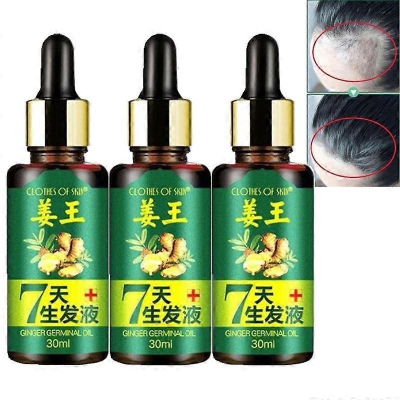 Λάδι ανάπτυξης τρίχας Τριχόπτωση Αραίωση Haircare Serum Φαλάκρα Γρήγορη παχιά μακριά οργανικά προϊόντα μαλλιών 30-90ML