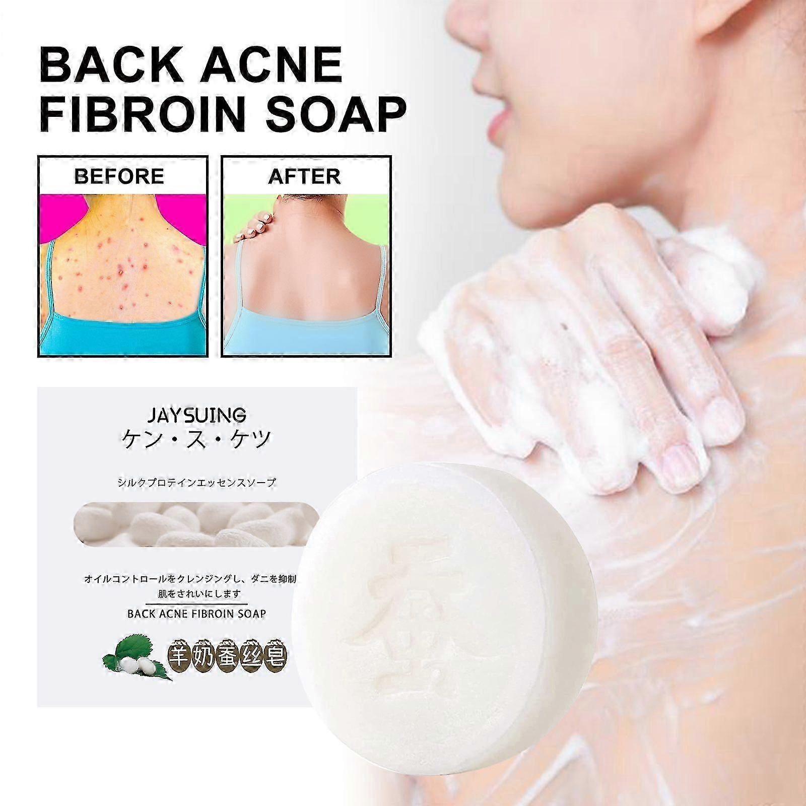 Anti-Acne Zijdezeep voor de Rug - Diep Reinigende Lichaamszeep met Geitenmelk & Zijdeproteïne, 60g