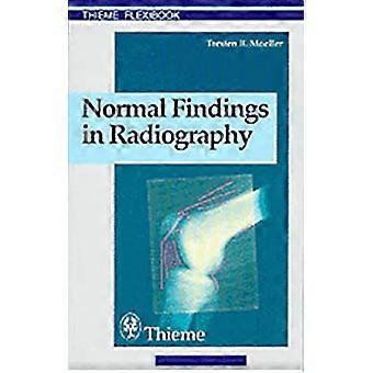 Normale bevindingen in de radiografie