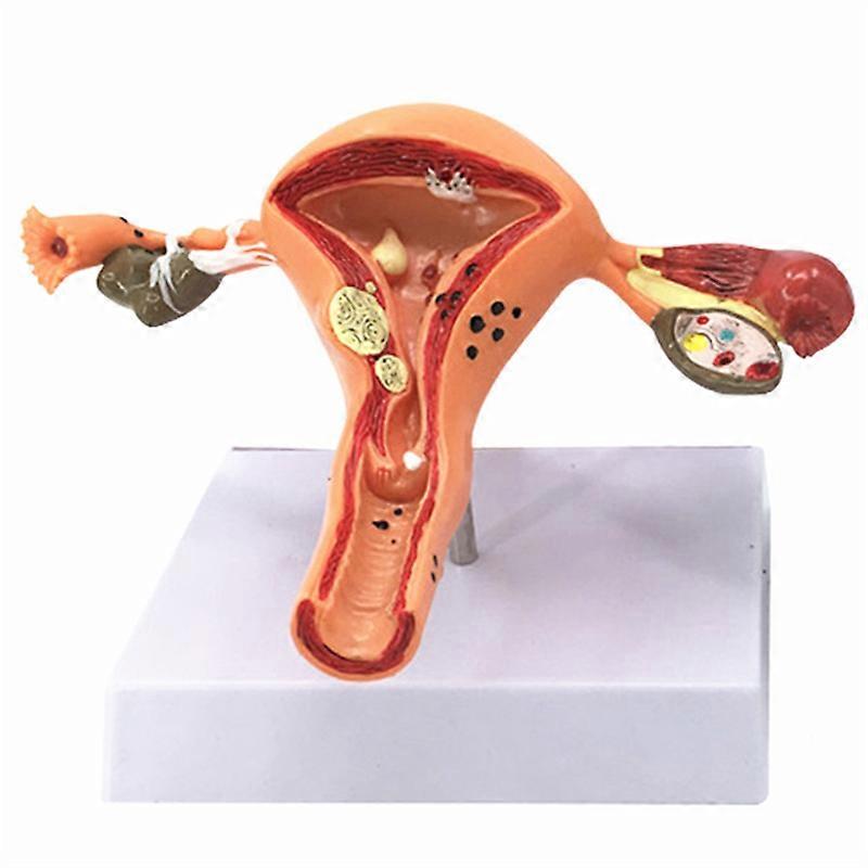 Female Uterus Structure Biological Models Educational Experiment
