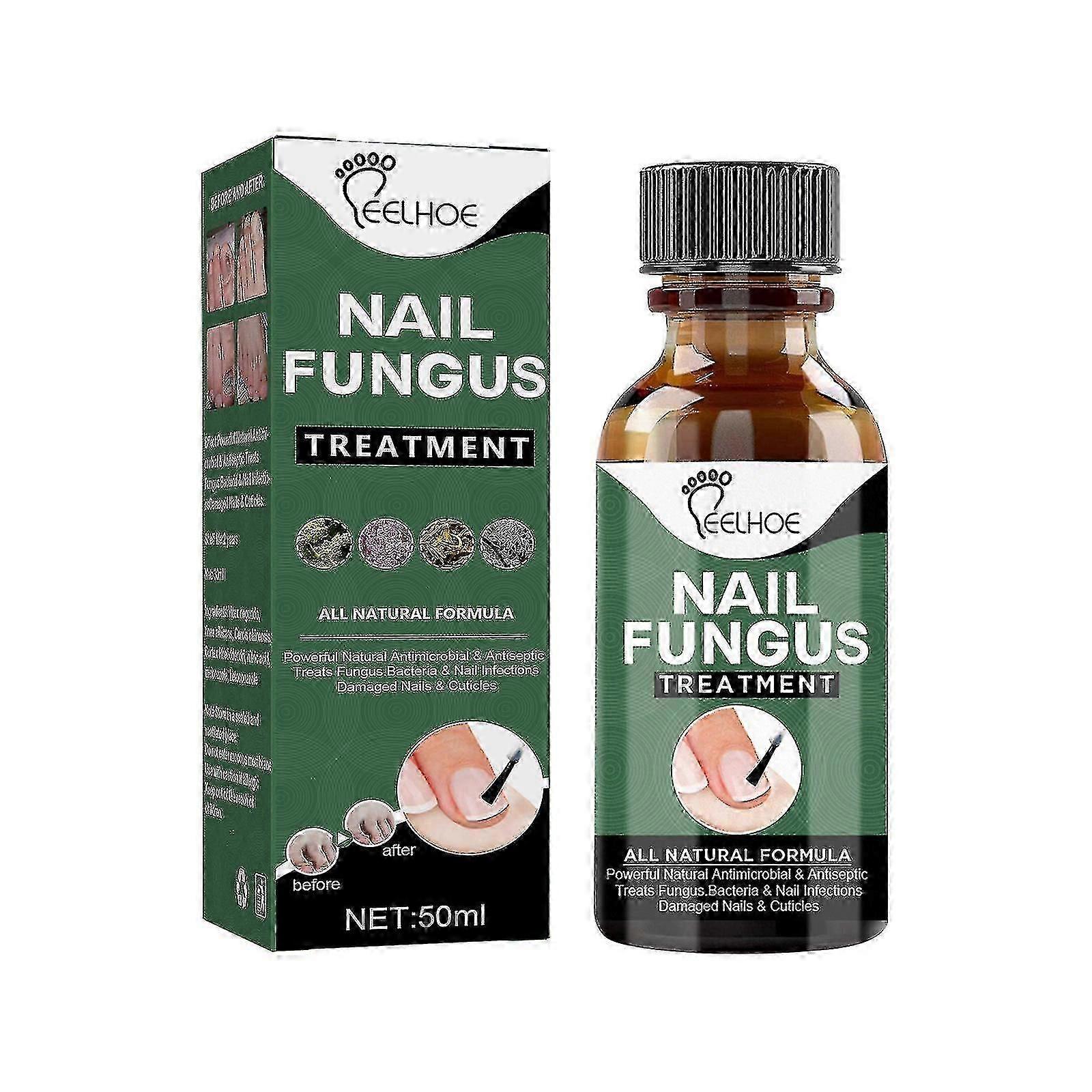 Traitement des champignons des ongles, Traitement des champignons des ongles 50 ml, Solution de réparation des ongles extra forte avec