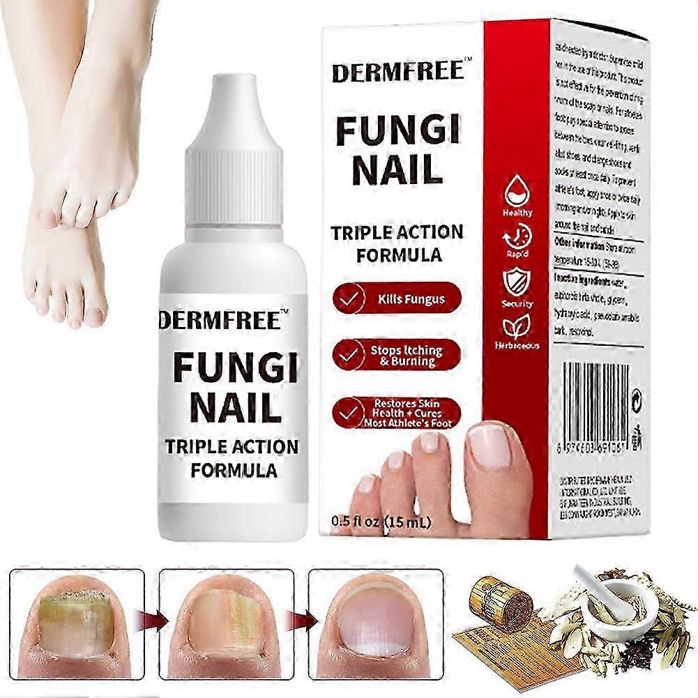15 מ"ל נוזל לטיפול בציפורניים נגד פטריות נוזל לחיזוק ציפורניים מהיר פעולה לתיקון ציפורניים ציוד לטיפוח ציפורניים