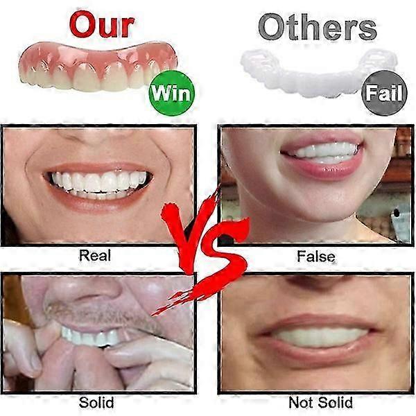 Upper/lower dentures perfect smile veneer dentures