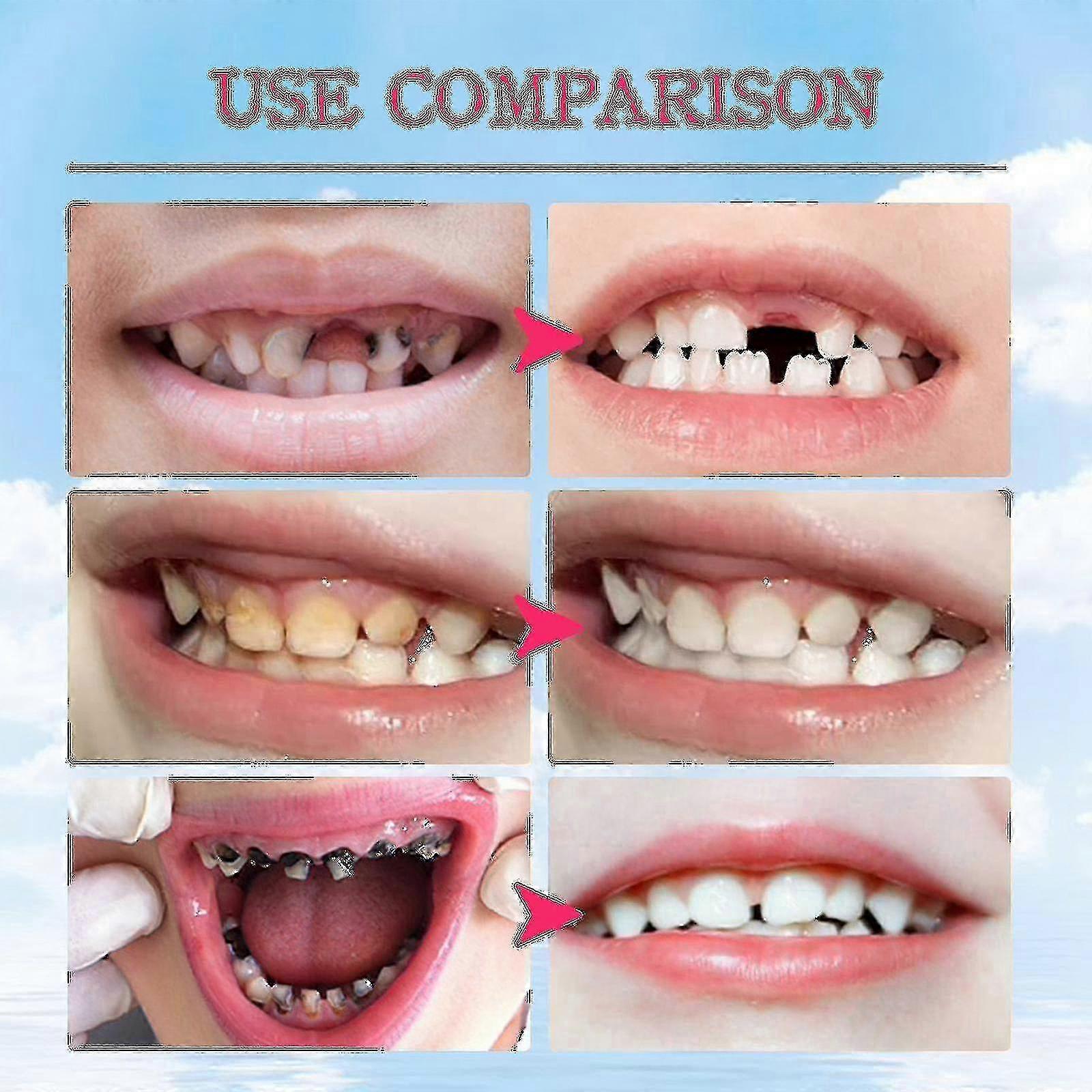 Jaysuing Children's Foam歯磨き粉歯磨き粉歯磨き歯磨き ブライトニング アンチキャビティ フルーツ フレーバー プレス ムース |
