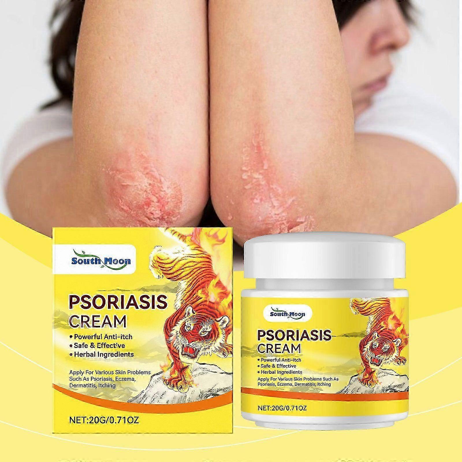 Psoriasis Cream, Skin Relief Anti-itch Cream Psoriasis Cream, Safe & Effective, Herbal Ingredients Skin Soothing & Nourishing