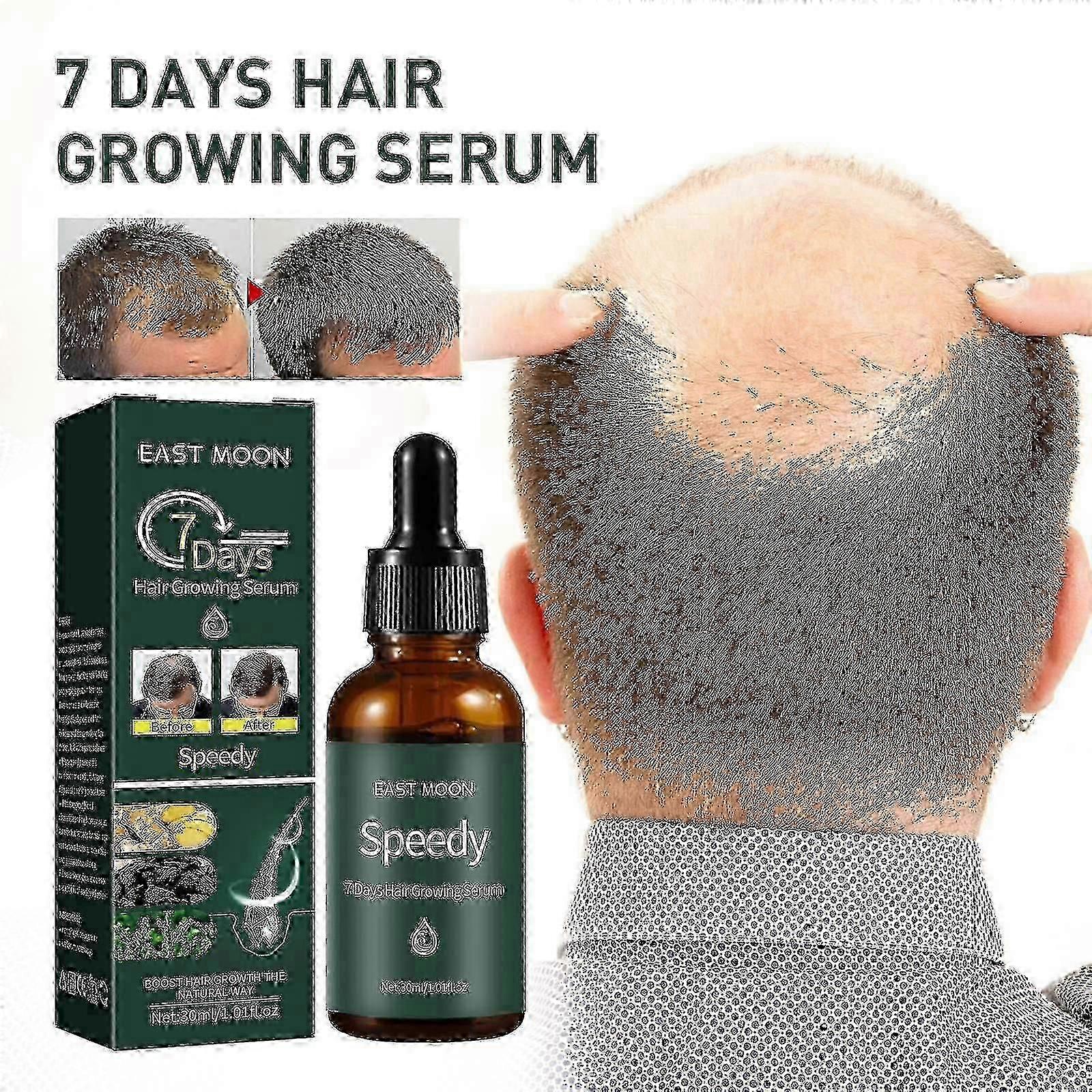 7days Growing Serum, Anti-detachment,hair Development30ml