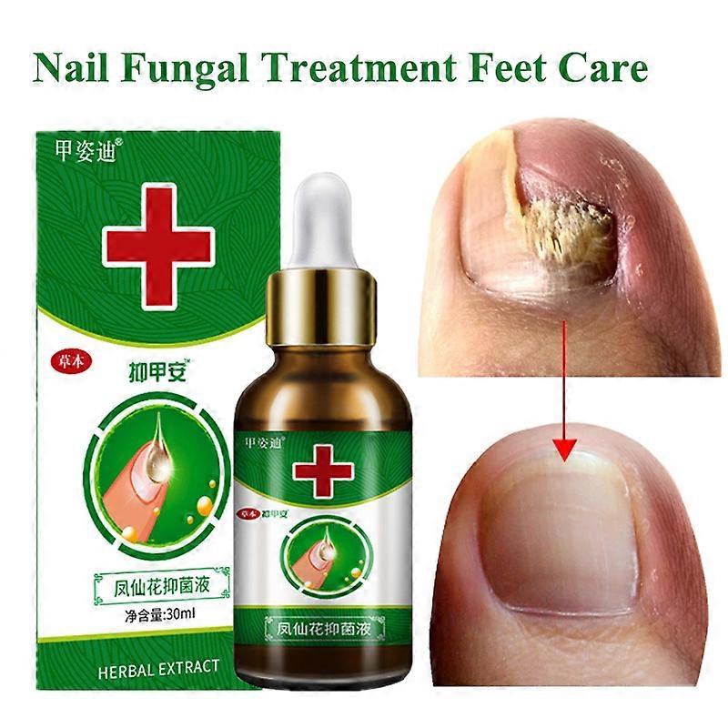 7DAYS תיקון פטרת ציפורניים טיפולים אסנס טיפוח כף הרגל סרום בוהן ציפורניים ג'ל להסרת פטריות נגד זיהום אוניכומיקוזיס