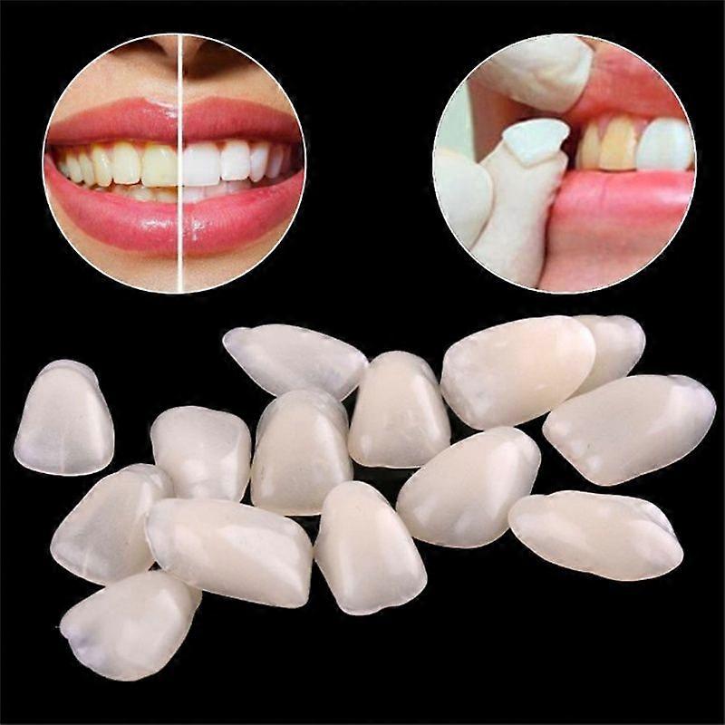 Dental Ultra İnce Beyazlatma Kaplamaları Reçine Diş Üst Ön Gölge A1 50 Adet