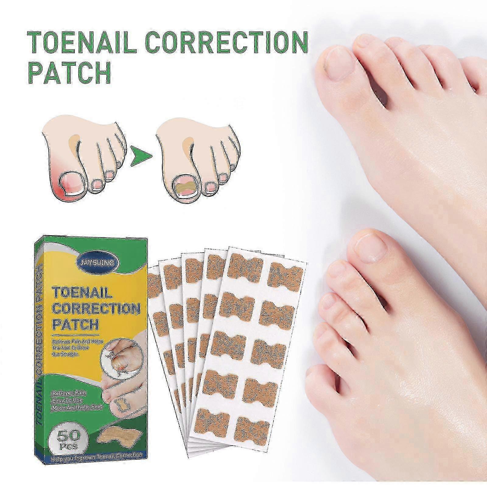 Jaysuing toenail groove correction stickers, manicure straightening stickers, nail repair toe ingrown toenail correction stickers BF |