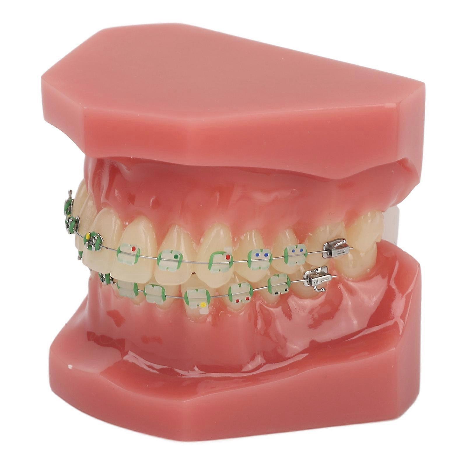 Dental Orthodontic Demonstration Teeth Model with Metal Wires and Bracket for Teaching Learning