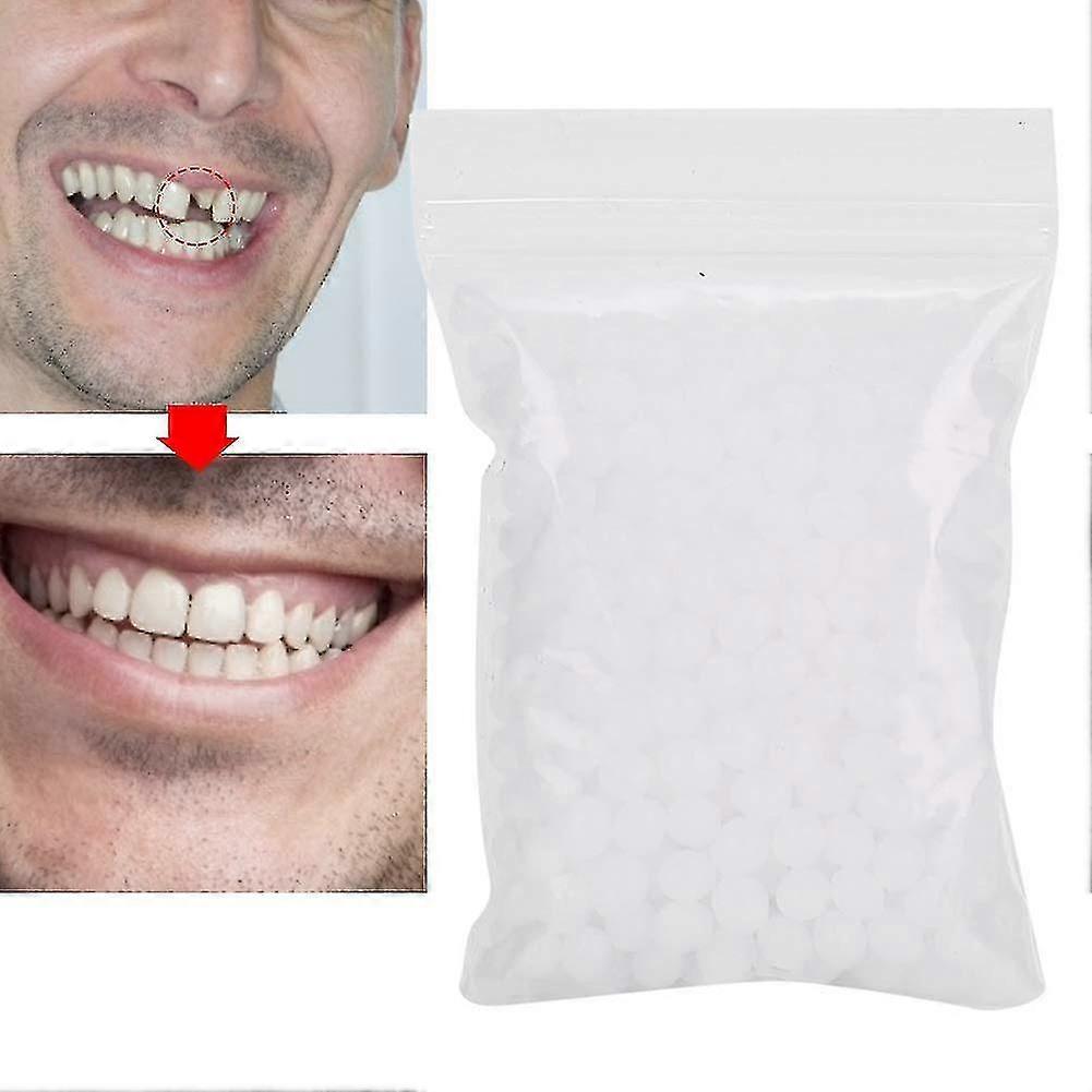 Dentures Temporary Teeth Instant Veneers Dentures Thermal Adhesive Beads Temporary Tooth Repair For Attaching Missing (100 G)