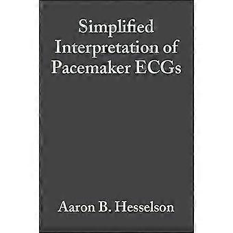 Simplified Interpretation of Pacemaker ECGs