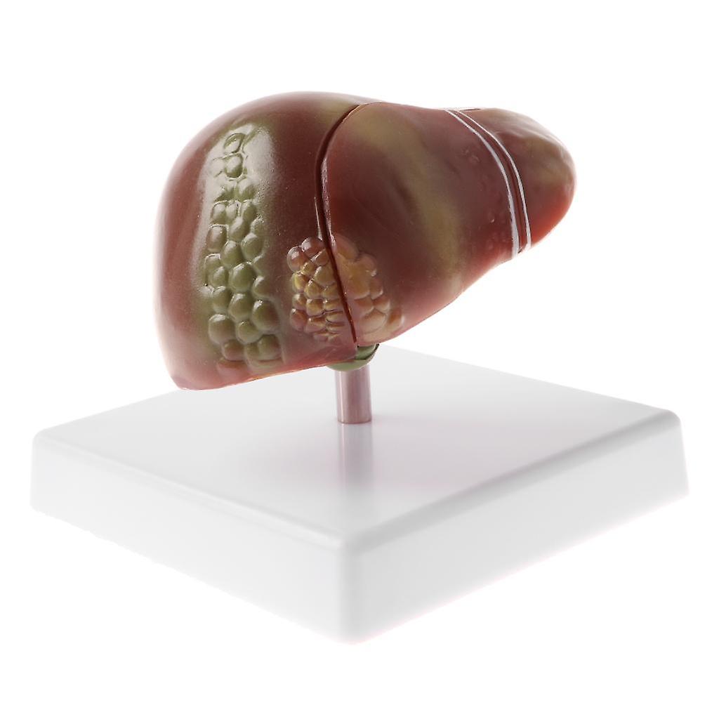 Anatomical  Human Liver Pathological Model for School  Teaching Kits