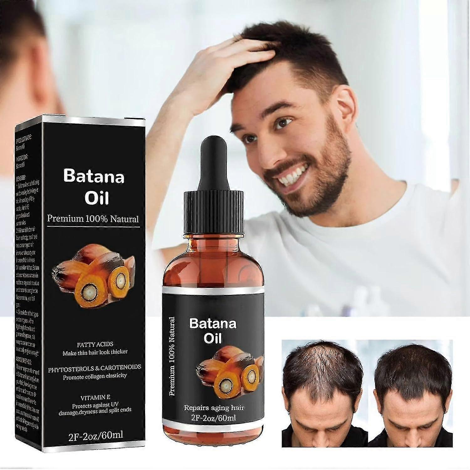 Batana Oil Για Υγιή Μαλλιά, 100% Batana Oil Care Treatments Ενισχύει τη Λάμψη του Δέρματος