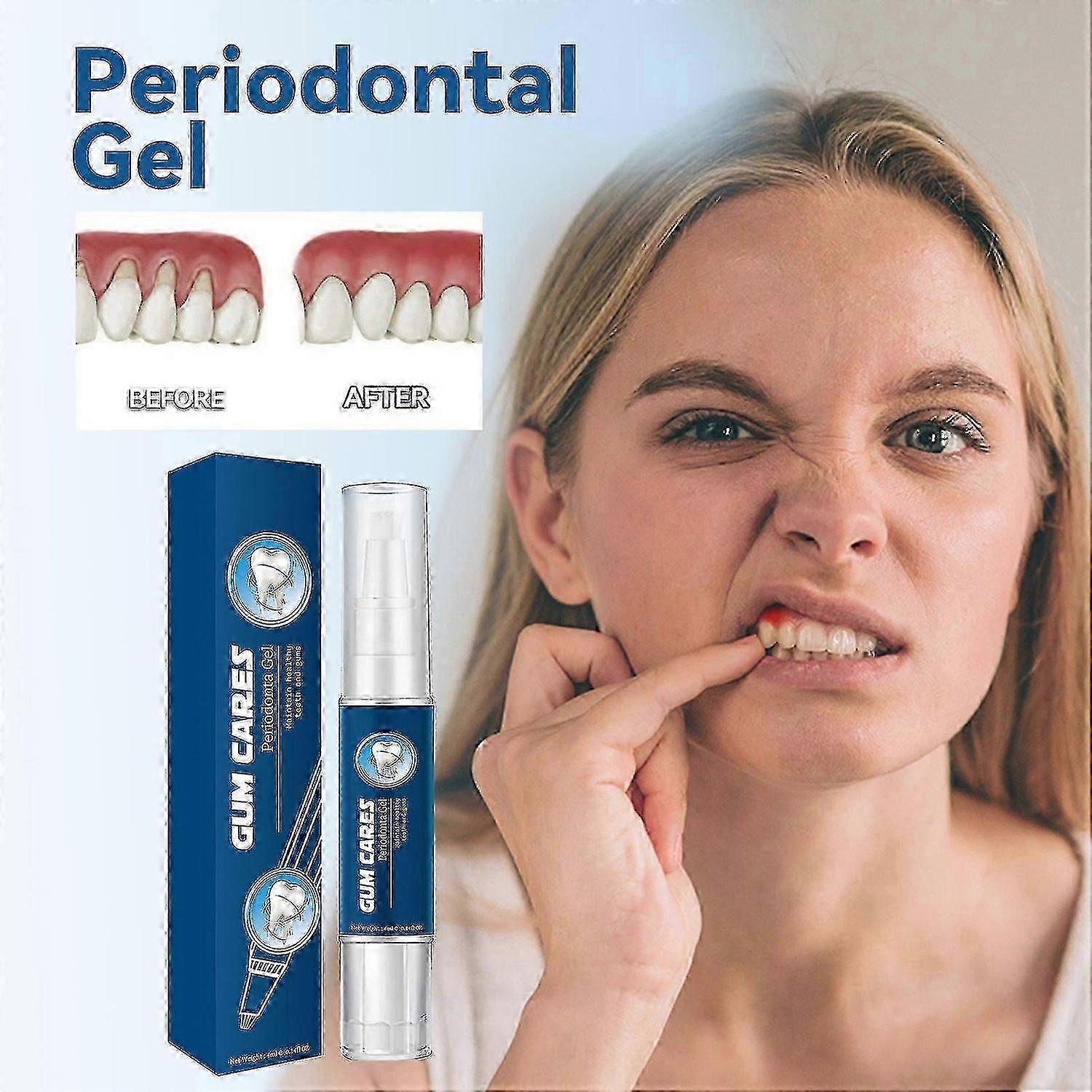 Gum Therapy Gel-4ml Βαθύς Καθαρισμός Λεκέδων Δοντιών, Πέτρας, Πονεμένων Ούλων, Gum Care Dental Cleansing Gel
