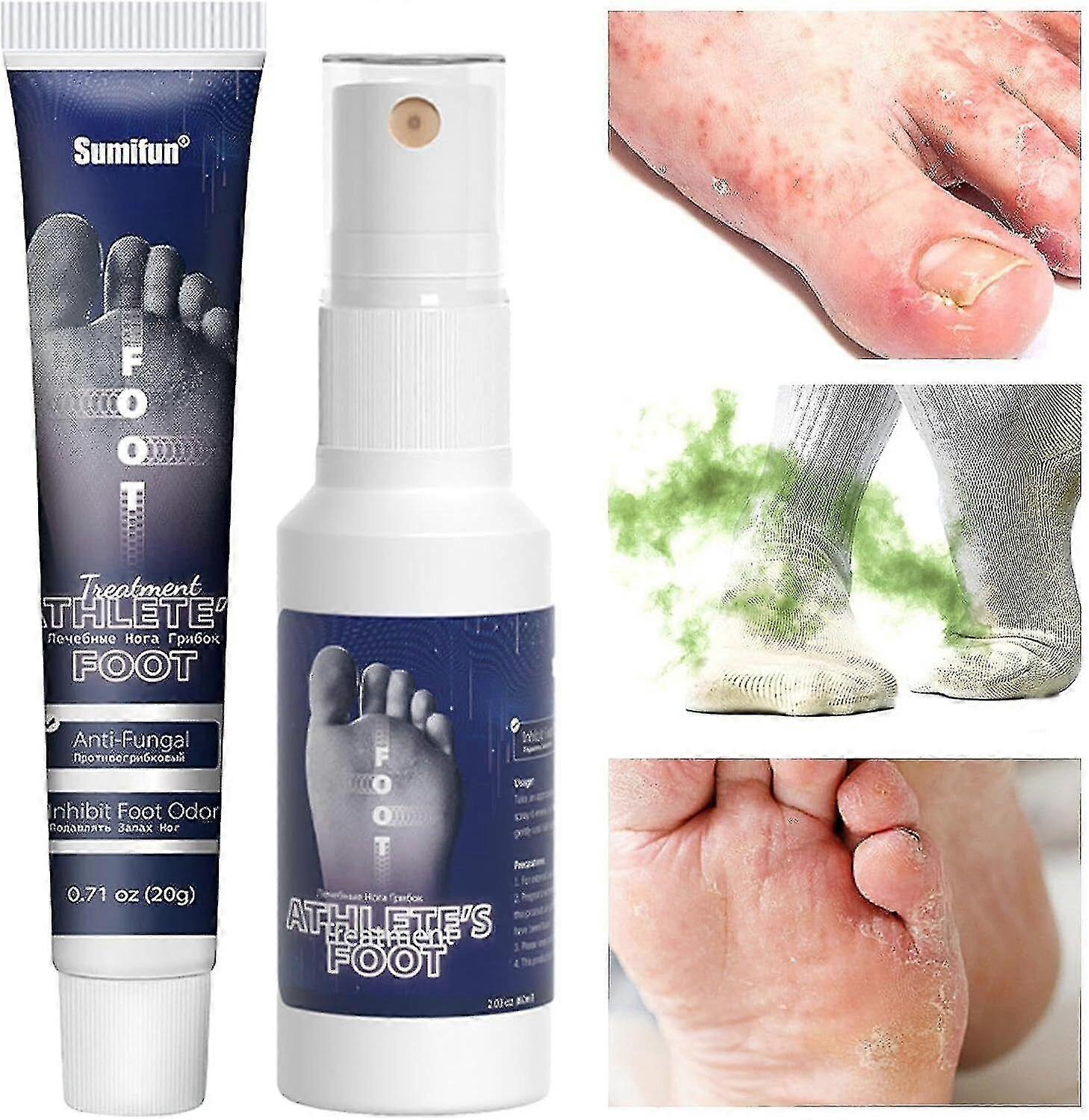 طقم كريم ورذاذ القدم الرياضي ، كريم رائحة القدم ، منتجات العناية بالقدم