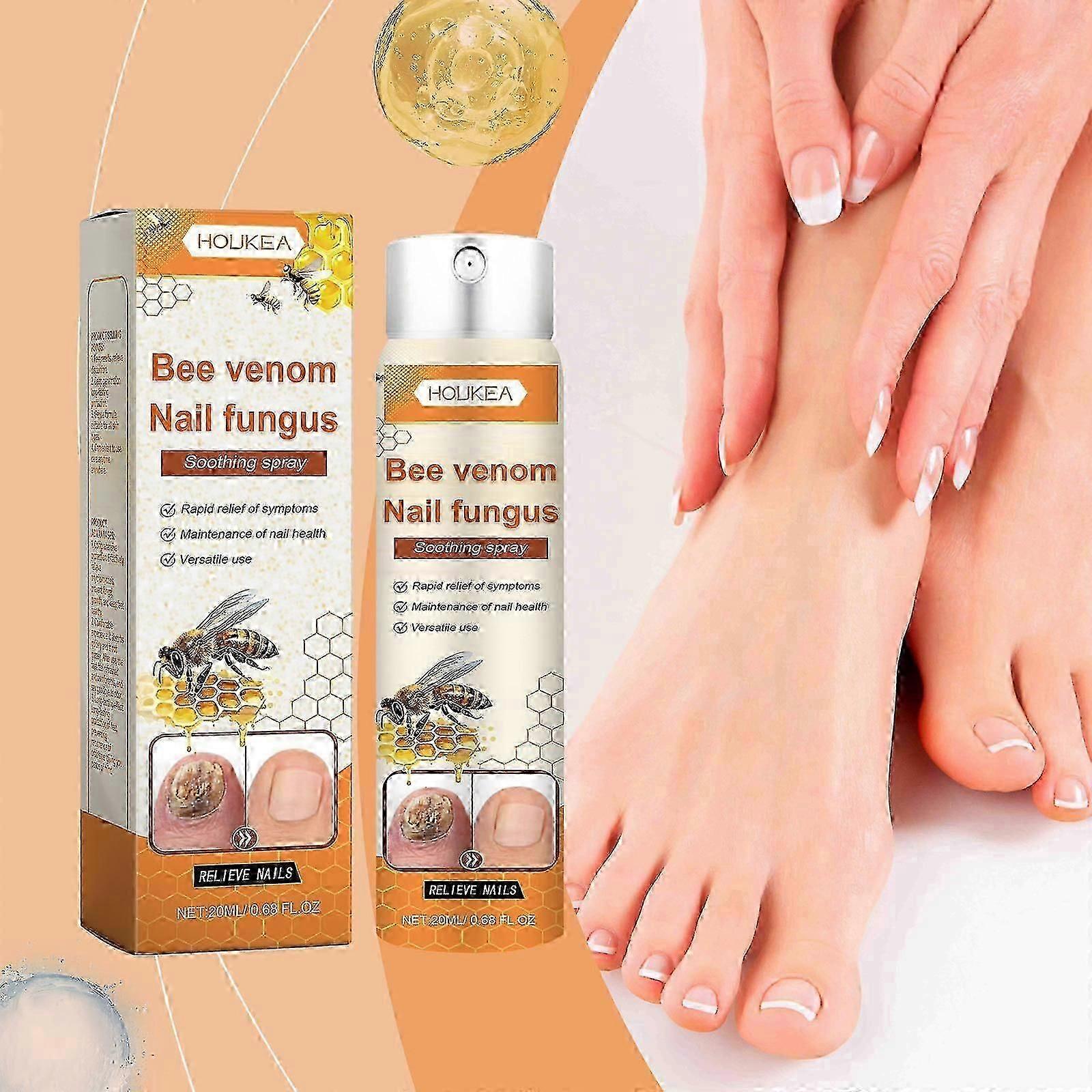 תמיסת טיפול בציפורניים נגד ארס דבורים, טיפול בפטרת ציפורניים נגד ארס דבורים, תמיסת תיקון ציפורניים חזקה במיוחד, תרסיס לטיפול בפטרת ציפורניים