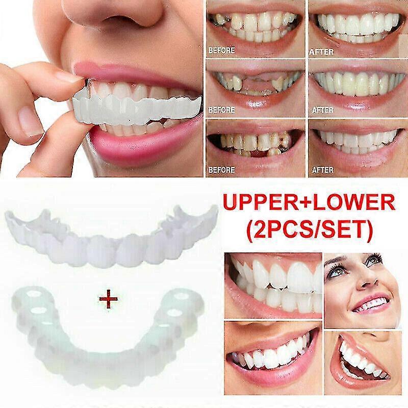 Snap On False Teeth Upper + Lower Dental Veneers Dentures Tooth Cover Set A