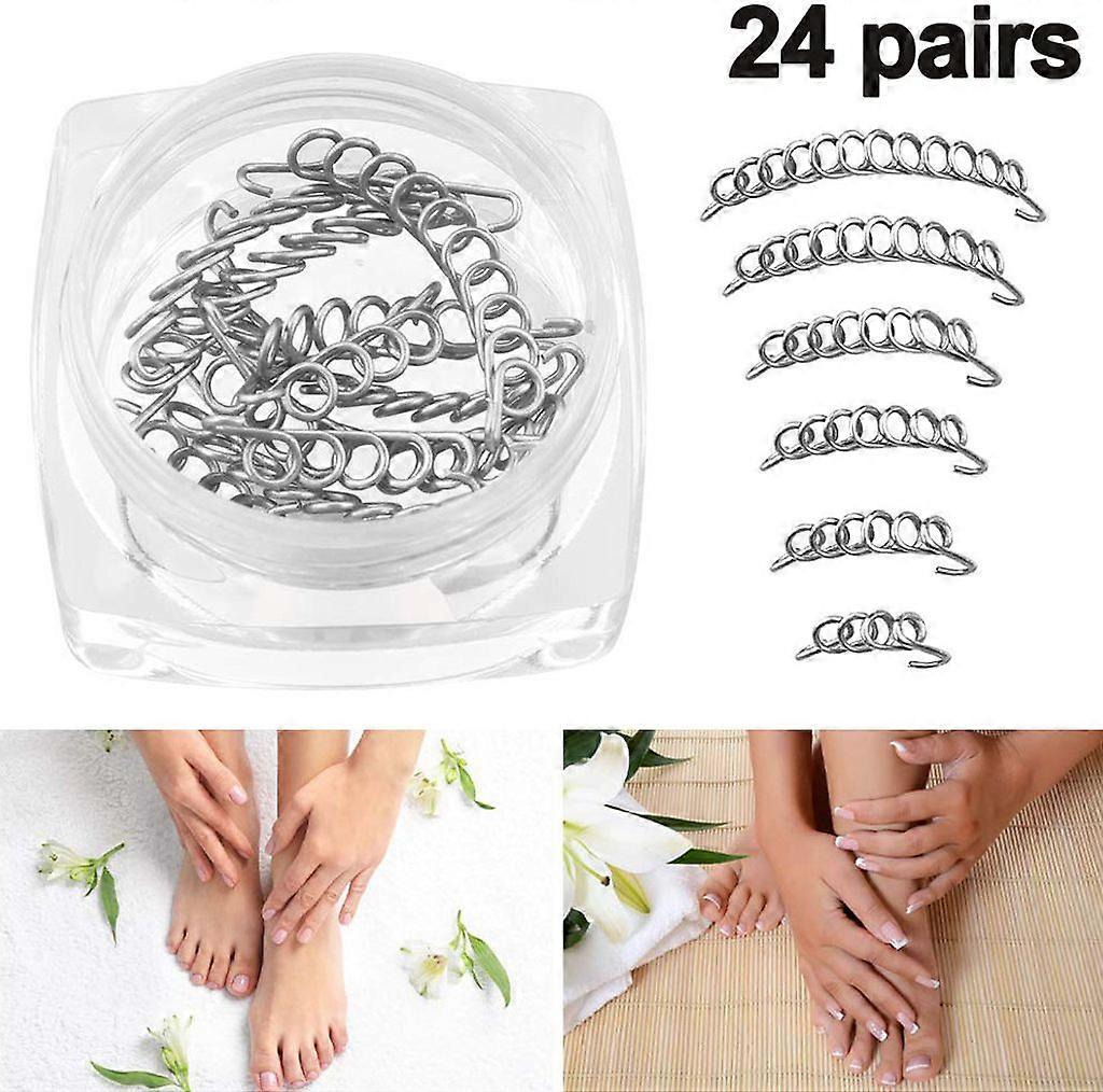 Toenail Correction Kit - 48 Pieces, Inline Toe Correctors, 6 Sizes