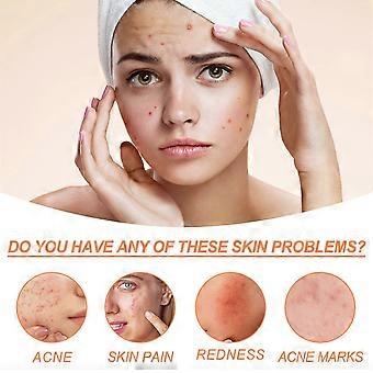 Tônico Brilhante para Refinamento de Acne e Poros - Acalma, Controla a Oleosidade, Reduz Marcas