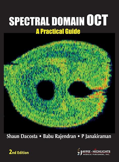 Spectral Domain Oct by Shaun Dacosta Hardback Book