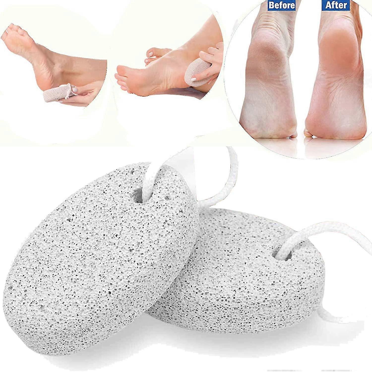 Set Of 2 Foot Pumice Stones For Foot Care
