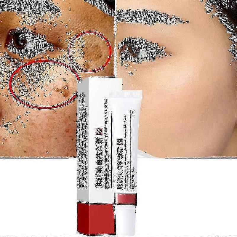 Cream To Remove Melasma And Melanin - 2023 Skin Care By Changzhao - In S And L Sizes Tw