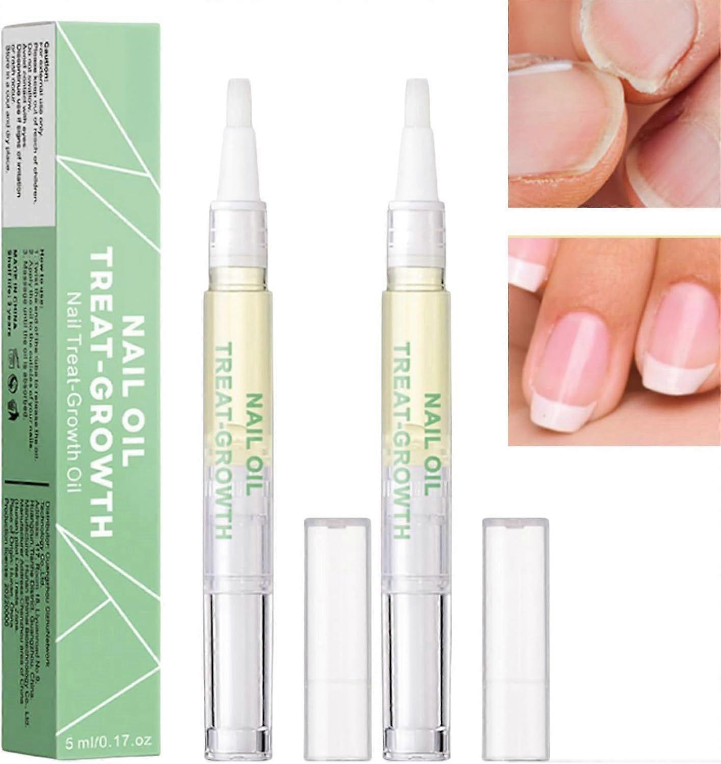2PCS Radiant Nail Growth Oil, Cuticle Oil for Nail, Radiant Nail Growth Oil Pen, Nail Strengthener, Nail Nutrition Pen for Moisturize Dry Nails